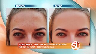 Turn Back Time Spa & Wellness Clinic offers up a in office treatment that totally changes the surface of your skin