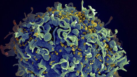 A New Cellular Therapy Targets HIV