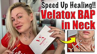 Get Soft Supple Skin with Velatox BAP in Neck from Acecosm.com | Code Jessica10 Saves you Money!