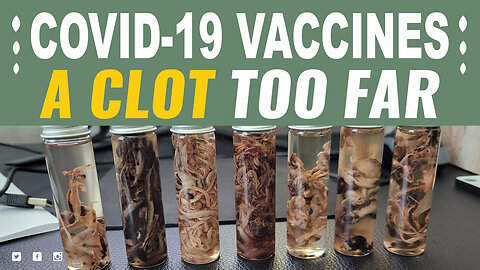 COVID-19 Vaccines Cause UNUSUAL Blood Clots - EXPERT TALK