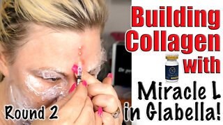 Building Collagen with Miracle L In the GLabella from AceCosm.com | Code Jessica10 Saves you Money!