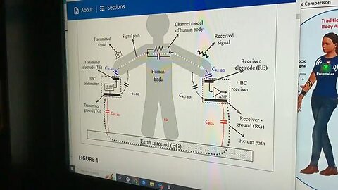 BANNET And Blockchain