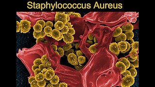 STAPHYLOCOCCUS AUREUS