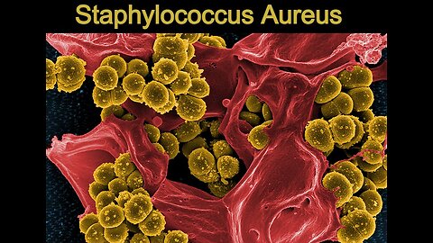 STAPHYLOCOCCUS AUREUS