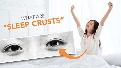 Why Your Eyes Are Crusty In The Morning