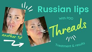 Pdo threads to plump lips | Russian lip technique