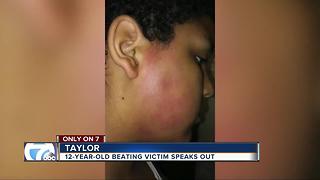12-year-old speaks out in brutal beating