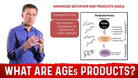 What Are Advanced Glycation End Products (AGEs)? – Dr. Berg
