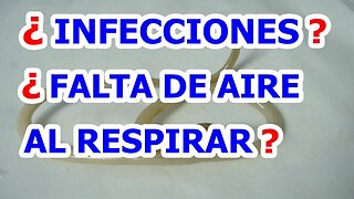 ¿TIENES TRASTORNOS DIGESTIVOS, CÓLICOS? OBSTRUCCIÓN BILIAR, ASMA, OTROS PROBLEMAS DE SALUD? ASCARIS