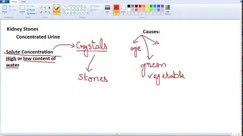 10th Class Bio Kidney Stones