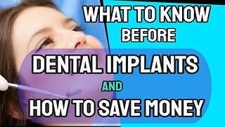 What to know before you get dental implant and how to save money doing it