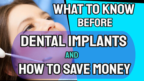 What to know before you get dental implant and how to save money doing it