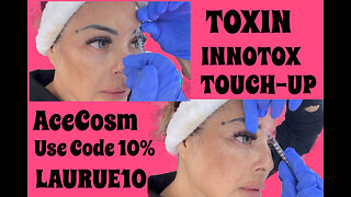 Innotox Toxin Touch-up My top number one favorite Botox