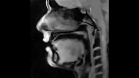 Real-time MRI scan of a person talking