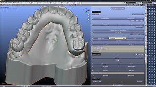 Support structure inside of a denture