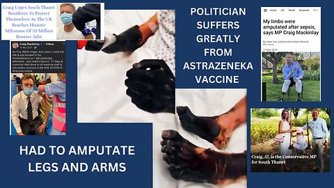 POLITICIAN SUFFERS GREATLY FROM VACCINE SHOT - HAD TO AMPUTATE LEGS AND ARMS
