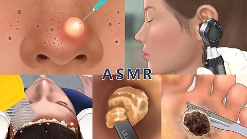 [ASMR]Care Animation Collection 4 (no music) | nose, foot, hair, ear care
