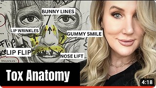 Botox Anatomy // Lip Flip & Bunny Lines