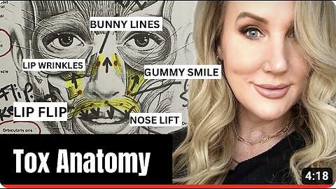 Botox Anatomy // Lip Flip & Bunny Lines