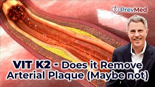 Vit K2 - Does it Remove Arterial Plaque?