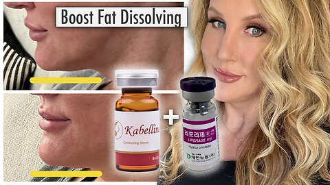 Boosting Fat Dissolver with Liporase