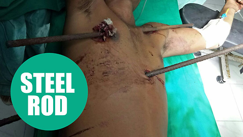 Astonishing survival of builder who fell off a roof and was impaled by two iron rods