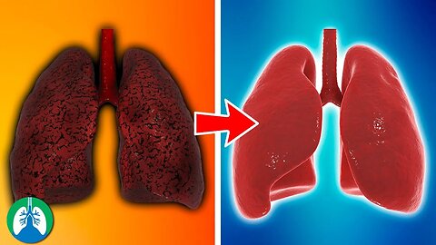 What Do Healthy Lungs Look Like? 🫁
