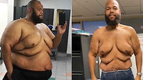 I Lost 250lbs - Now I'm Proud Of My Body | BRAND NEW ME