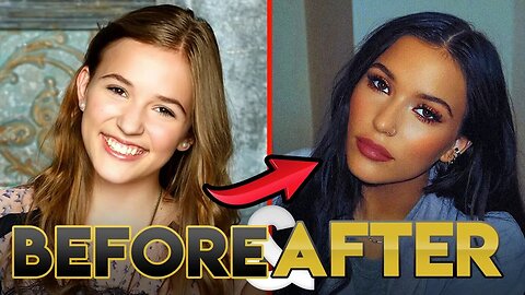Lennon Stella Glow Up 2019 | Before and After Transformations ( Lips, Hair, Diet & More )