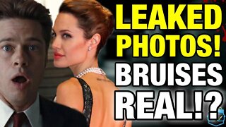 LEAKED PHOTOS! The New Amber Heard? Are Angelina Jolie's Bruises REAL!? Did Brad Pitt ATTACK Her!?