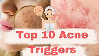 "Top 10 Acne Triggers: Expert Tips for Clear, Glowing Skin"