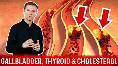 The Gallbladder, Thyroid & Cholesterol Link (Part - 4) – Dr. Berg