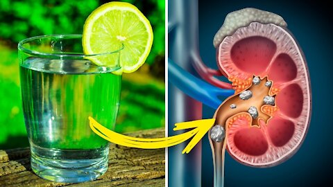 8 Health Problems You Can Cure With Lemon Juice