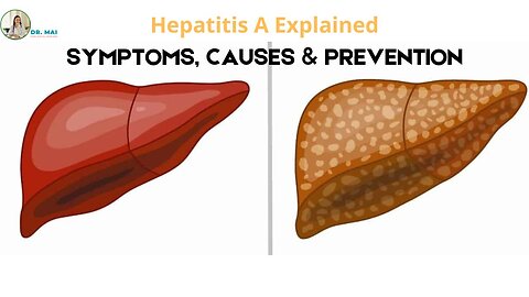 Hepatitis A: Contagious Liver Infection - Symptoms, Causes & Prevention | DR. MAI