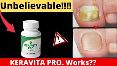 KERAVITA PRO REVIEW - WARNING AND ALERT! KERAVITA PRO SUPPLEMENT for Nail fungus - KERAVITA PRO 2022