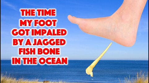 The Time My Foot Got Impaled By a Jagged Fish Bone in the Ocean