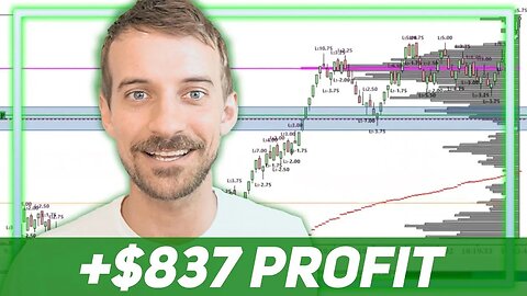 Trading Live Experience using Volume Profile | +$837 Profit
