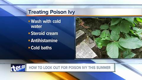 How to look out (and treat) poison ivy this summer--5pm