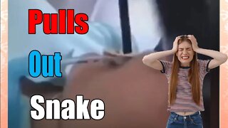 Doctor Pulls Out Snake From Womans Mouth In Raw Video