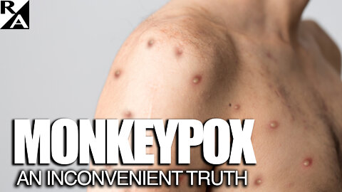 Monkeypox: An Inconvenient Truth (This Video Is Not on YouTube)