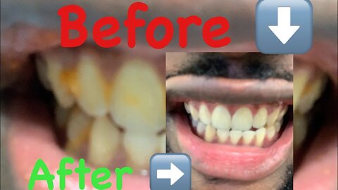 Do this for oral technique instead GUARANTEED PEARL WHITES…