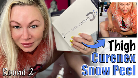 Curenex Snow Peel on Thighs, round 2 from Celestapro.com (w/ Numbing) | Code Jessica10 saves you $$$