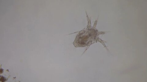 Arthropod under microscope! Bet it makes you jump a bit!