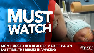 Mom Hugged Her Dead Premature Baby 1 Last Time. The Result is amazing