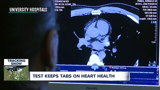 UH offers heart attack assessment test for free during February