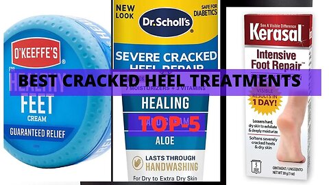 Best Cracked Heel Treatments That Actually Work