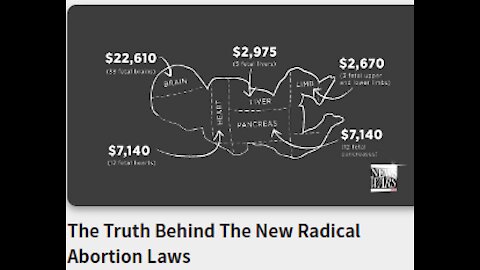 The Truth Behind The New Radical Abortion Laws-Babies are worth more in pieces