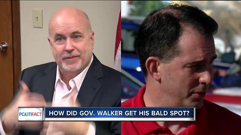 Politifact: How did Gov. Walker get his bald spot?