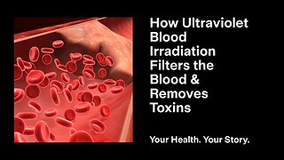 How Ultraviolet Blood Irradiation Filters the Blood & Removes Toxins