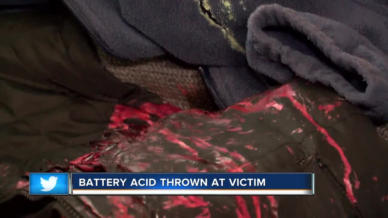 Man attacked with battery acid in Milwaukee